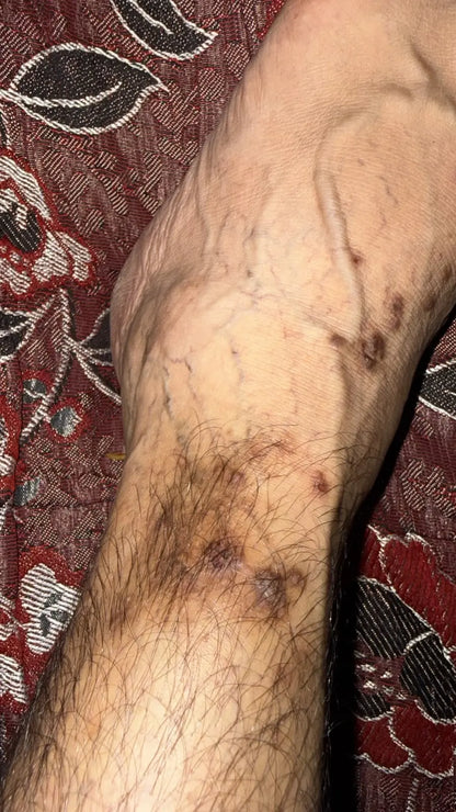 Go Psoriasis Organic Cream texture close-up