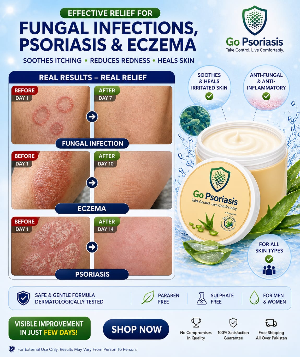 Go Psoriasis